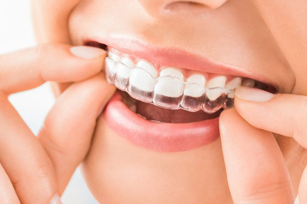 Brackets