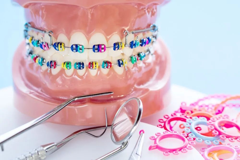 Brackets