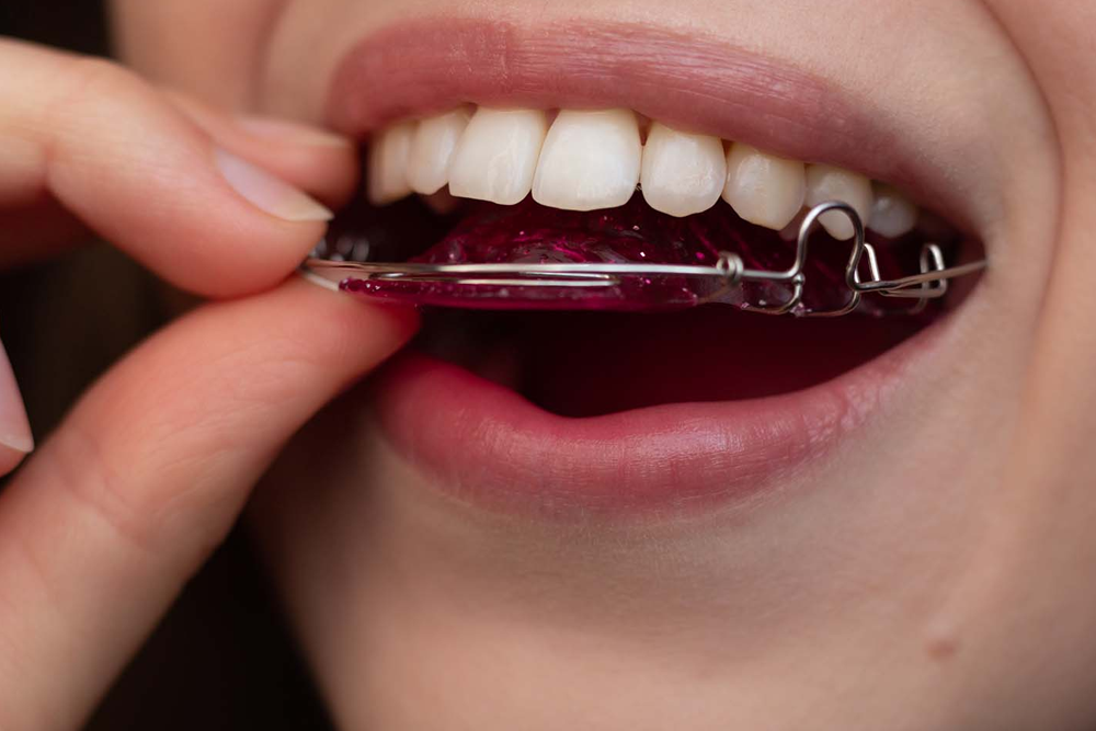 Brackets